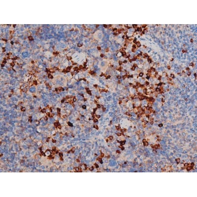 CDC25A Antibody (phospho-Ser178)