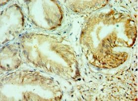 COL10A1 / Collagen X Antibody (aa521-680)