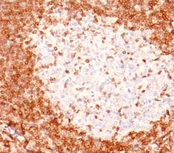 BCL2 / Bcl-2 Antibody (aa41-54, clone 8C8, Ready-to-Use)