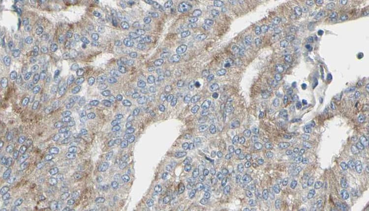IL2RG / CD132 Antibody