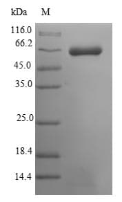 Mouse MUSK Protein (Recombinant 10His-SUMO, N-terminus + Myc, C-terminus)