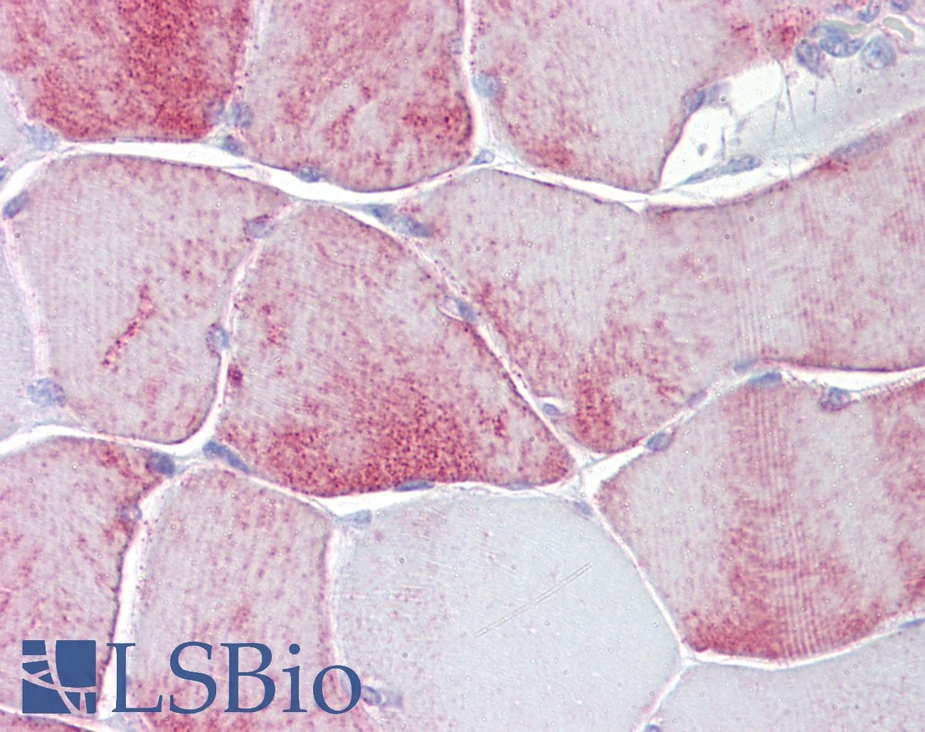 IHC-plus™ KCNK13 / THIK-1 Antibody