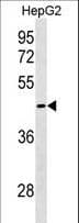 Polyclonal Rabbit anti-Human GIPC3 Antibody (aa243-272, WB)
