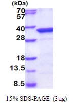 Human PPM1D / WIP1 Protein (Recombinant His)