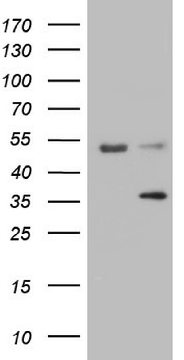 IHC-plus™ Monoclonal Mouse anti-Human LGALS9 / Galectin 9 Antibody (clone 21B5, IHC, WB)