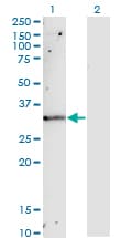 TIMP1 Antibody (clone 4D12)