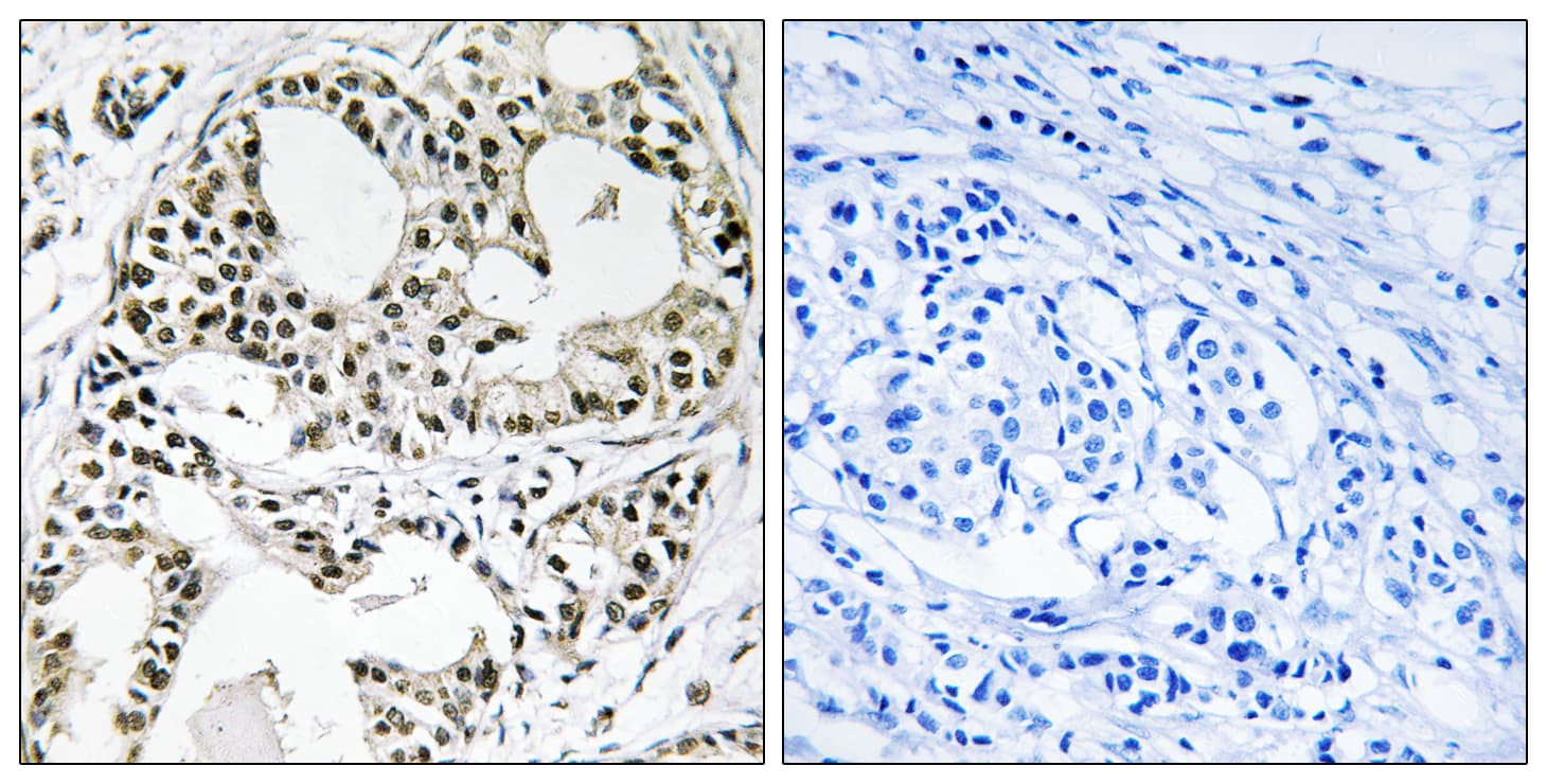 YEATS2 Antibody (aa341-390)