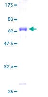 Human ADH5 Protein (Recombinant GST)
