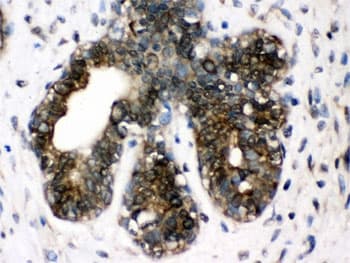 Polyclonal Rabbit anti-Human CCT4 / SRB Antibody (IHC, WB)