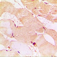 Polyclonal Rabbit anti-Human Dysferlin Antibody (C-Terminus, IHC, WB)