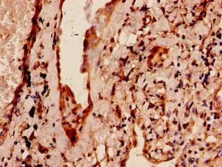Polyclonal Rabbit anti-Human MAP4 Antibody (IHC, IF)