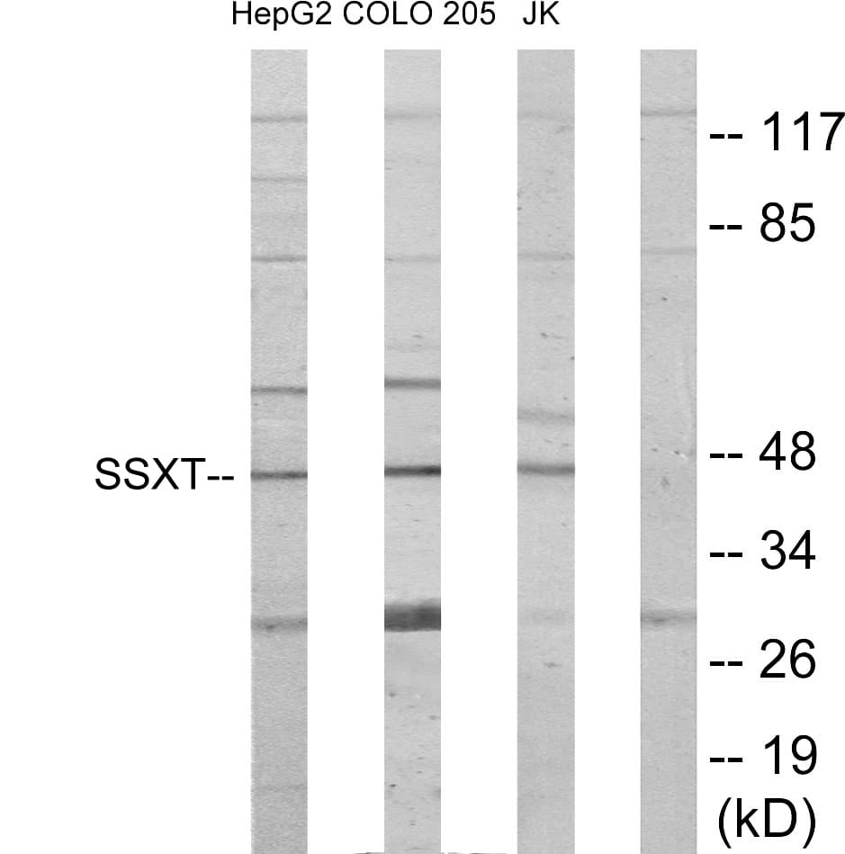 IHC-plus™ Polyclonal Rabbit anti-Human SS18 Antibody (aa1-50, IHC, WB)