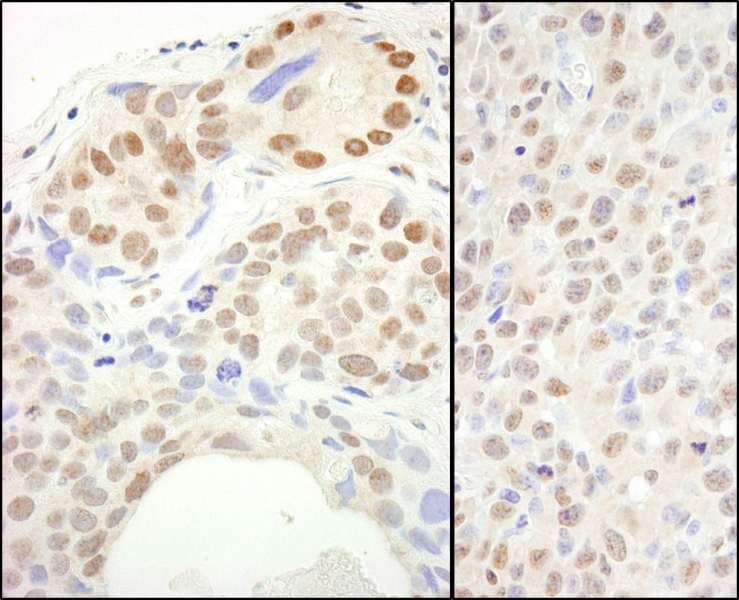 Polyclonal Rabbit anti-Human SUPT6H / SPT6 Antibody (aa425-475, IHC, WB)