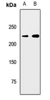 MYH7 Antibody