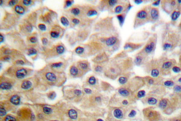 Polyclonal Rabbit anti-Human PDGFRB / PDGFR Beta Antibody (Asp1003, IHC, IF)