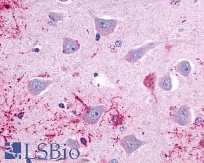 PathPlus™ Polyclonal Rabbit anti-Human HTR7 / 5HT7 Receptor Antibody (C-Terminus, IHC)