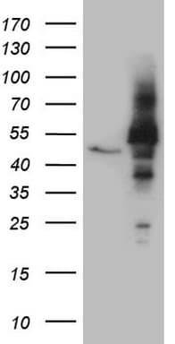 Monoclonal Mouse anti-Human NOB1 / NOB1P Antibody (clone OTI4H3, aa2-234, WB)