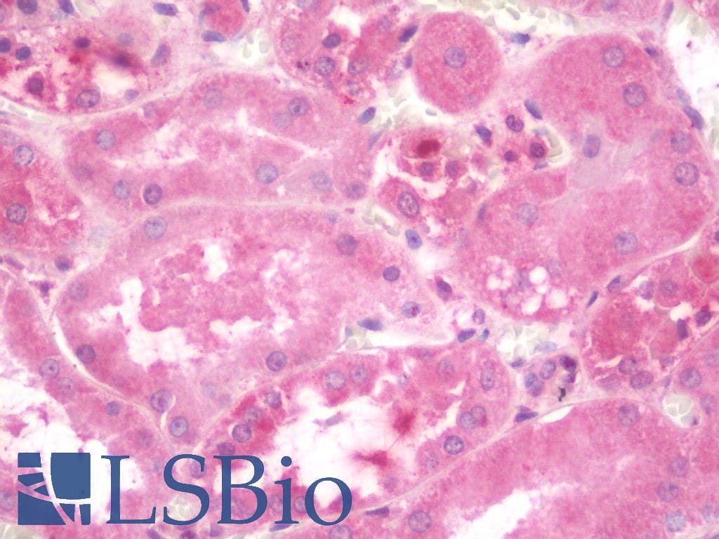 IHC-plus™ Polyclonal Rabbit anti-Human UNG / Uracil DNA Glycosylase Antibody (IHC, IF, WB)
