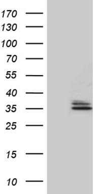 TNFSF10 / TRAIL Antibody (aa39-281, clone OTI2C12)