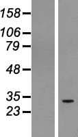RUSC1-AS1 / C1orf104 Protein (Over-Expression Lysate Myc-DDK (Flag))