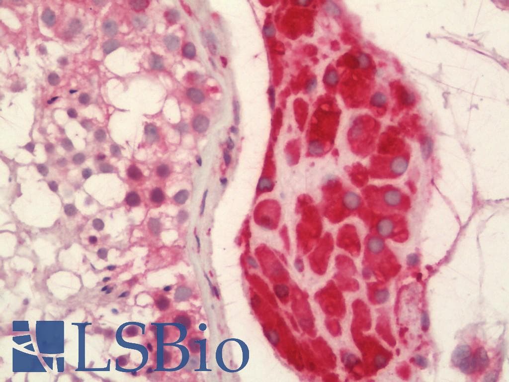 IHC-plus™ Junctin / ASPH Antibody