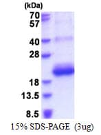 Human CD164L2 Protein (Recombinant His)