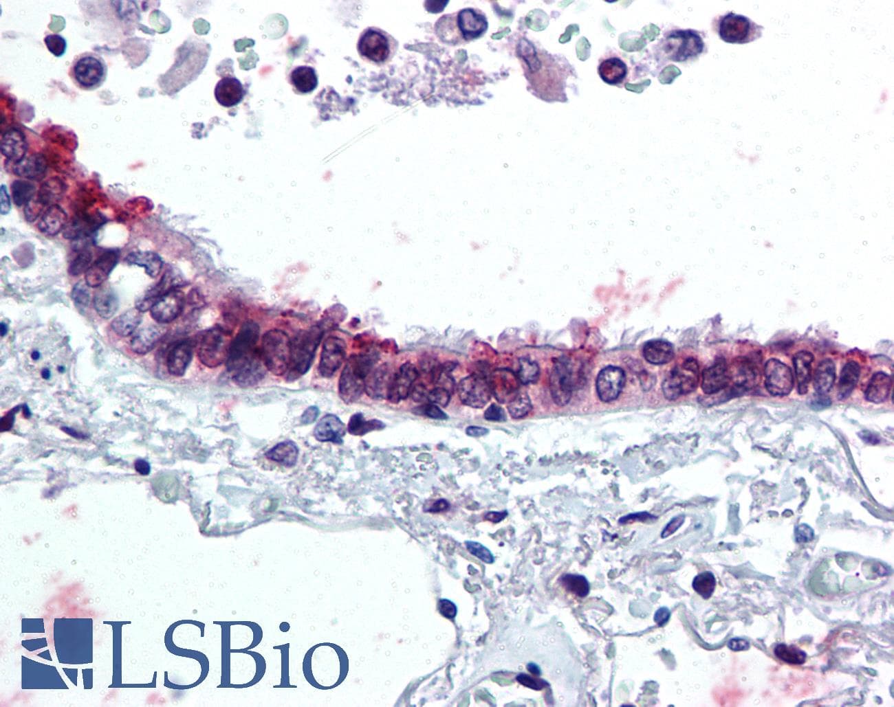 IHC-plus™ Polyclonal Rabbit anti-Human IL6 / Interleukin 6 Antibody (Internal, IHC)