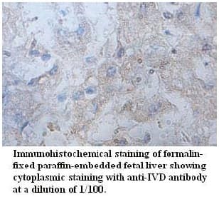 Polyclonal Rabbit anti-Human IVD Antibody (aa188-341, IHC)