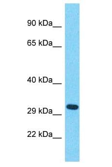 Polyclonal Rabbit anti-Human OR56B1 Antibody (aa150-199, WB)