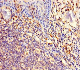C11orf85 Antibody