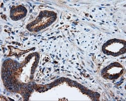 PIM2 / Pim-2 Antibody (clone OTI8G10)