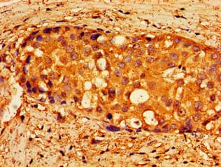NPTX1 Antibody