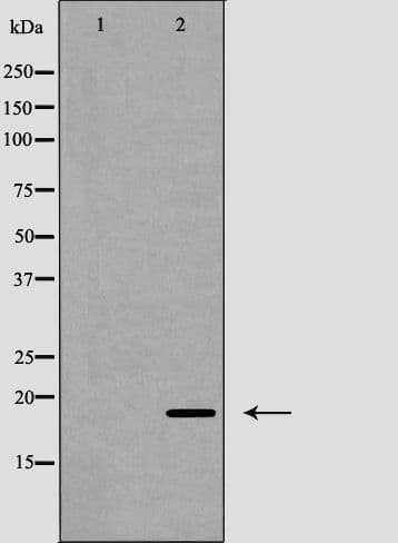 Polyclonal Rabbit anti-Human CD247 / CD3 Zeta Antibody (phospho-Tyr142, IF, WB)
