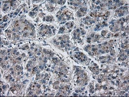 PRL / Prolactin Antibody (clone OTI11B11)