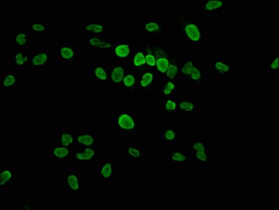 HIST1H1E Antibody (phospho-Thr17)