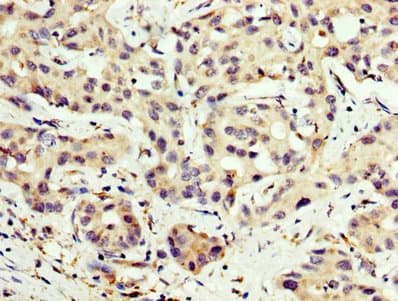 Polyclonal Rabbit anti-Human CPT2 Antibody (IHC)
