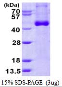 Human IL12B / IL12 p40 Protein (Recombinant His)