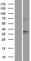 TMEM87A Protein (Over-Expression Lysate Myc-DDK (Flag))