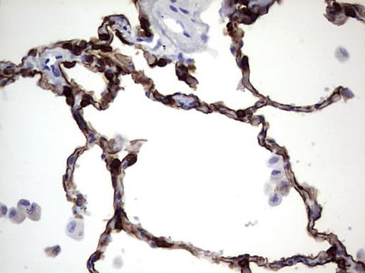 KRT19 / CK19 / Cytokeratin 19 Antibody (aa240-390, clone OTI8A1)