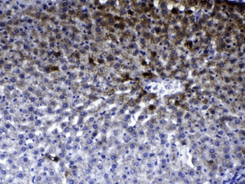 Polyclonal Rabbit anti-Human ERBB2 / HER2 Antibody (IHC, WB)