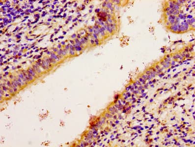 RPS6KA2 / RSK3 Antibody