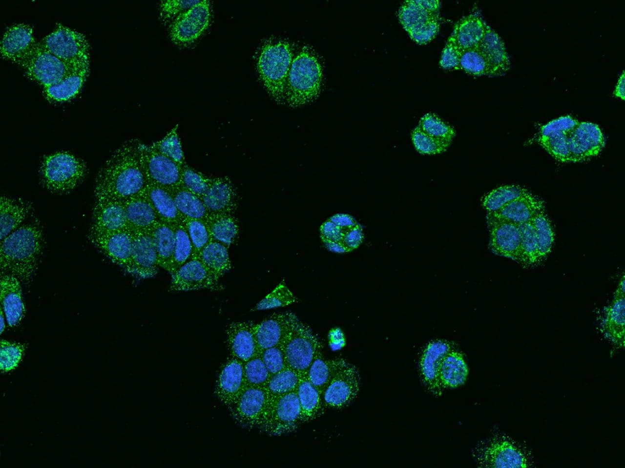 Polyclonal Rabbit anti-Human RABEP2 Antibody (IF)