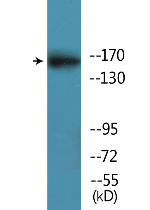 GRIN2B / NMDAR2B / NR2B Antibody (phospho-Ser1303)