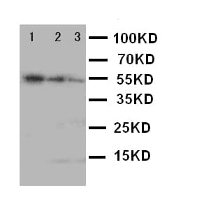 MKI67 / Ki67 Antibody (aa3234-3256)
