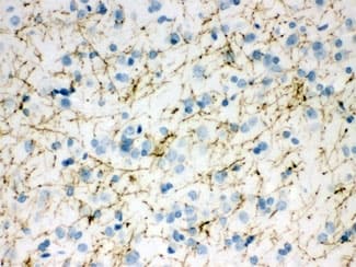 Polyclonal Rabbit anti-Human Tyrosine Hydroxylase Antibody (IHC, WB)