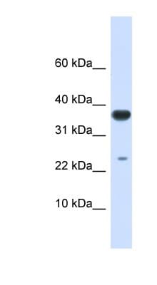 Polyclonal Rabbit anti-Human UBE2D2 / UBCH5B Antibody (aa36-85, WB)