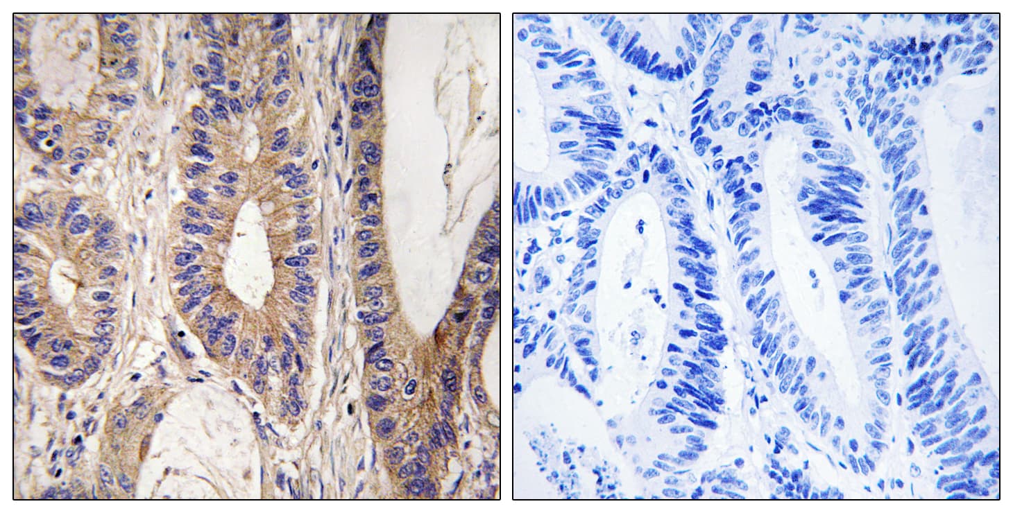 RENT1 / UPF1 Antibody (aa299-348)