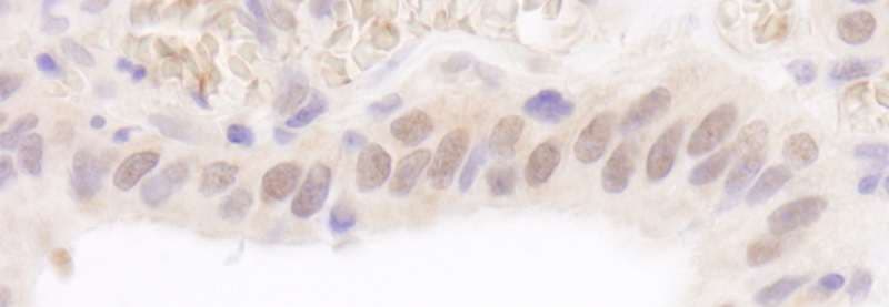 UBE2A Antibody (aa10-50)