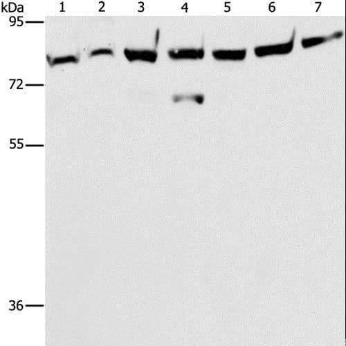 PRKCE / PKC-Epsilon Antibody