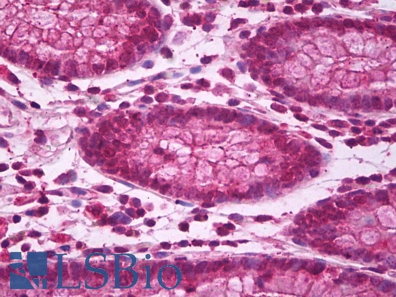 IHC-plus™ BBC3 / PUMA Antibody (aa2-16)